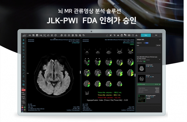 제이엘케이 뇌관류 MR 영상 분석 솔루션 JLK-PWI. /사진=제이엘케이